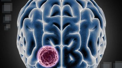 ابداع روشی تازه برای شبیهسازی تومور مغزی در مرکز تحقیقات سرطان آلمان 4 دانشمندان آلمانی روشی تازه را برای رشد تومورهای مغزی بیماران در آزمایشگاه ابداع کردهاند که ساختار اصلی و ویژگیهای مولکولی تومور بیمار را تا حد امکان شبیهسازی میکند.