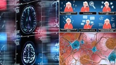 چرا زنان بیشتر از مردان آلزایمر می‌گیرند؟