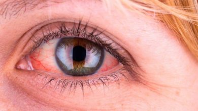 علائمی که نشان میدهد چشمان شما در خطر است 9 علائمی که نشان میدهد چشمان شما در خطر است