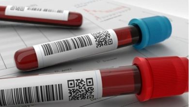 کمخونی و تأثیر آن بر MCH در آزمایش خون + روشهای درمان 1 کمخونی و تأثیر آن بر MCH در آزمایش خون + روشهای درمان