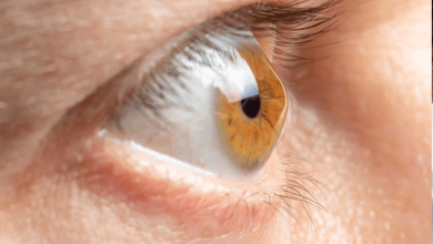 آیا قوز قرنیه باعث کوری میشود؟ 1 آیا قوز قرنیه باعث کوری میشود؟