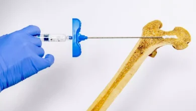 دانشمندان ژل تزریقی جدیدی برای درمان سریع پوکی استخوان توسعه دادند 9 دانشمندان ژل تزریقی جدیدی برای درمان سریع پوکی استخوان توسعه دادند