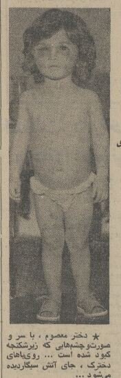 بازداشت پدر و مادری که به طرز وحشیانه‌ای فرزند 3 ساله‌شان را شکنجه می‌کردند! +عکس