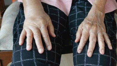 شایع‌ترین دلیل آرتروز «چاقی» است
