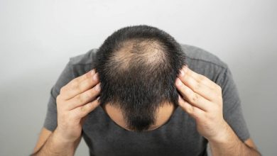 آیا از نظر علمی، امکان رویش مجدد موهای ریخته سر وجود دارد؟