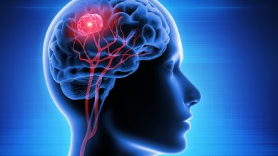 روش نوین تشخیص تومور مغزی؛ پاسخ چندساعته 7 روش نوین تشخیص تومور مغزی؛ پاسخ چندساعته