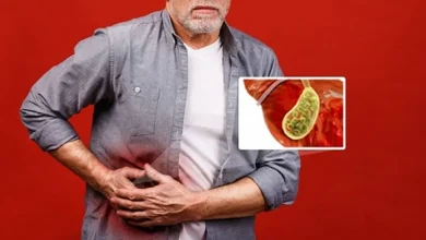 سنگ صفرا، پیامد پنهان چاقی 6 سنگ صفرا، پیامد پنهان چاقی