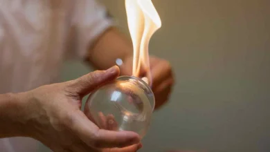 با فواید درمانی حجامت بیش‌تر آشنا شوید