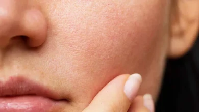 چرا باید تغییر در خال‌های پوستی را جدی بگیریم
