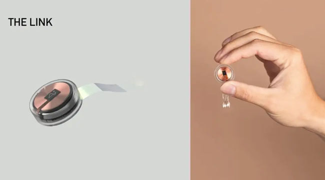 کاشت تراشه در مغز دو فرد دیگر