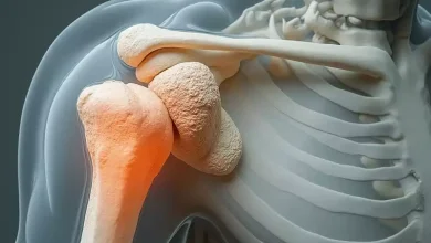 توصیه به ورزشکاران: علائم ناپایداری شانه را جدی بگیرید