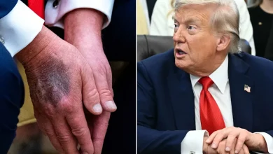 واکنش جالب معاون رئیس‌جمهور آمریکا به کبودی دست دونالد ترامپ