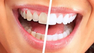 ارتباط رنگ دندان و سلامتی چیست؟ 3 با این ویتامینها دندانهای سفید و براق داشته باشید