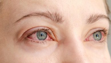 چند راهکار ساده برای مقابله با قرمزی و خارش چشم در فصل پاییز 9 چند راهکار ساده برای مقابله با قرمزی و خارش چشم در فصل پاییز