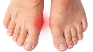 علائم درد شست پا را سرسری نگیرید!