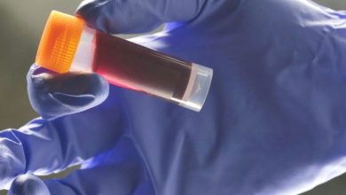 پژوهش جدید: ارتباط جالب گروه خونی با خطر سکته مغزی زودهنگام