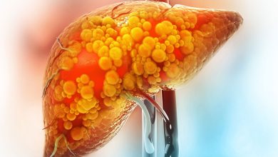 امید تازه برای بیماران؛ داروی جدید بیماری کبد چرب متابولیک را متوقف می‌کند