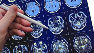 بیخوابی روند پیری مغز را تسریع میکند 7 بیخوابی روند پیری مغز را تسریع میکند