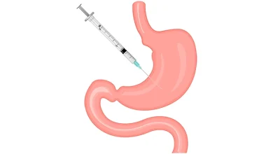 بوتاکس معده؛ راهکار موقت لاغری یا درمانی معجزهآسا؟ 4 بوتاکس معده؛ راهکار موقت لاغری یا درمانی معجزهآسا؟