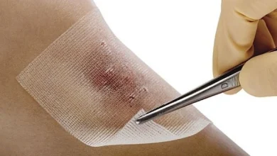 تأثیر شگفتانگیز بانداژ با هوش مصنوعی در ترمیم زخمها 6 تأثیر شگفتانگیز بانداز با هوش مصنوعی در ترمیم زخمها