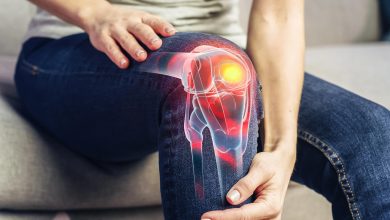 چه خوراکی‌هایی برای تقویت مفاصل مفید هستند؟