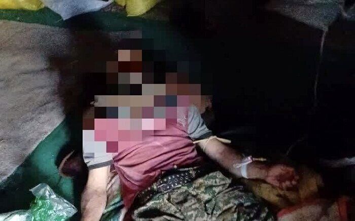 حمله خرس به نوجوان 16 ساله در بروجن +عکس 2 حمله خرس به نوجوان 16 ساله در بروجن