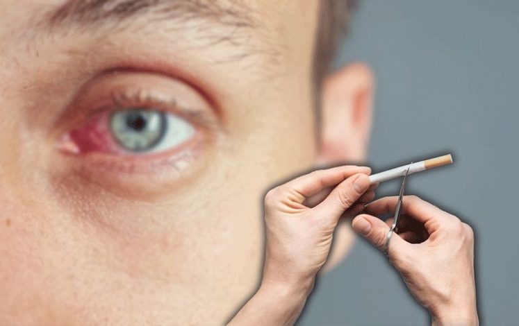 سیگار کشیدن چه تأثیری روی چشم‌ها می‌گذارد؟
