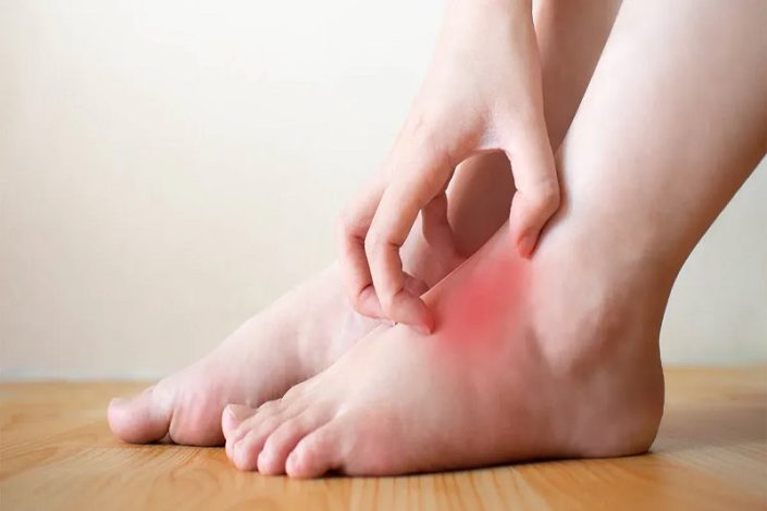 بهترین خوراکی ها برای کاهش التهاب بدن
